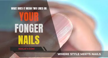 Finger Nail Lines: What They Mean and How to Interpret