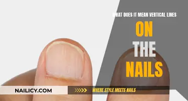 Unraveling the Mystery: Vertical Lines on Your Nails