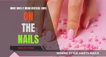 Vertical Lines on Nails: What Do They Mean?