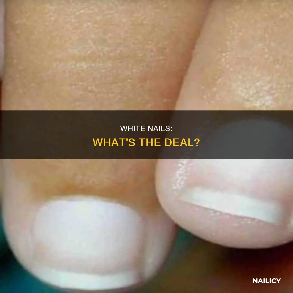 what does it mean when a girl has white nails