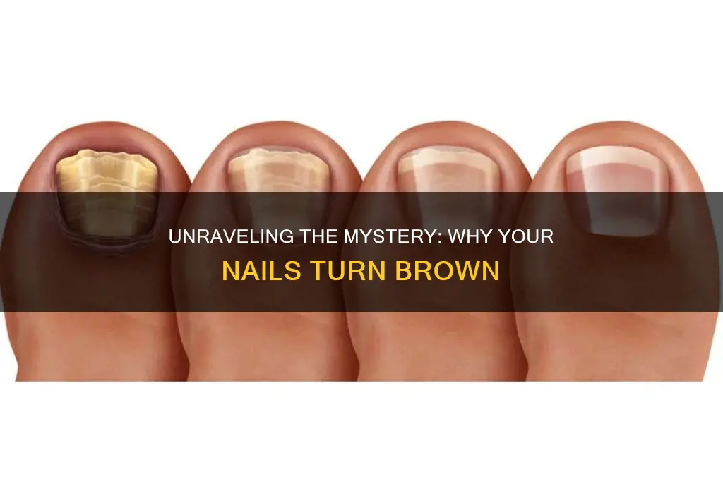 what does it mean when finger nails turns brown