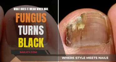 Nail Fungus Turning Black: Understanding the Serious Warning Sign