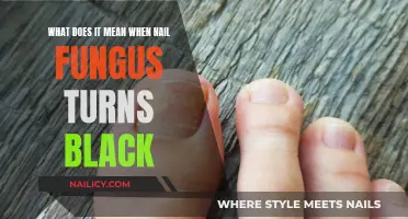 Nail Fungus Turning Black: What Does It Mean?
