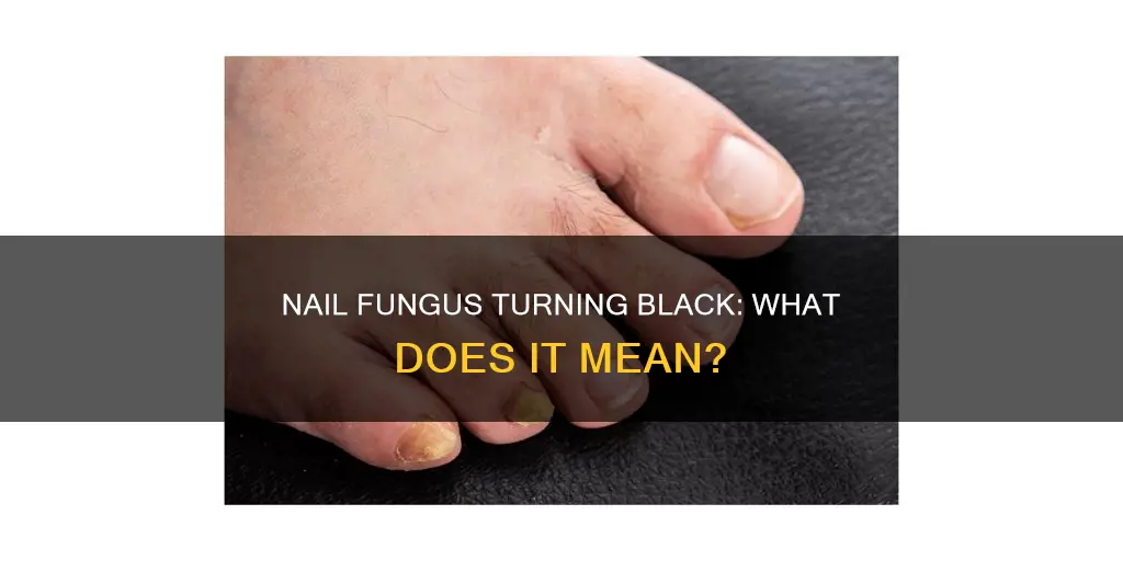what does it mean when nail fungus turns black