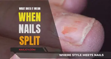 Nail Splits: Understanding the Causes and Treatment Options