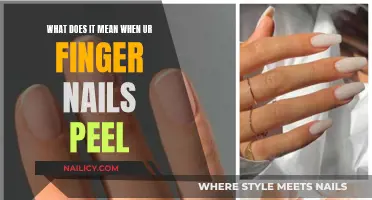 The Mystery of Peeling Fingernails: What's the Cause?
