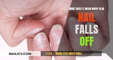 Nail Falling Off: What Your Body Is Telling You