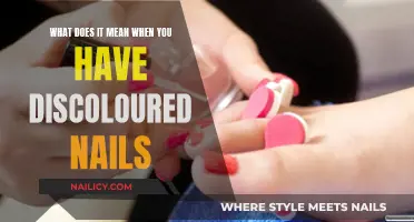 Nail Discoloration: What Your Nails Are Trying to Tell You