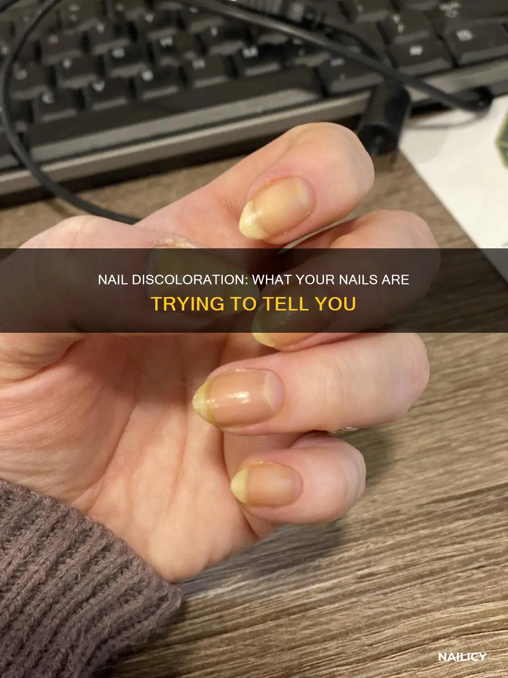 what does it mean when you have discoloured nails