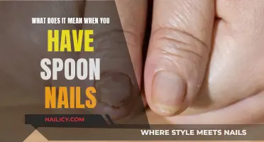 Unraveling the Mystery: Understanding the Causes of Spoon Nails