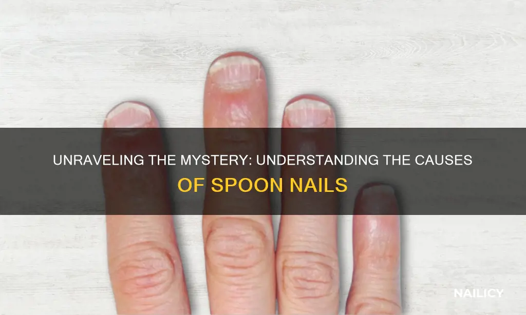 what does it mean when you have spoon nails