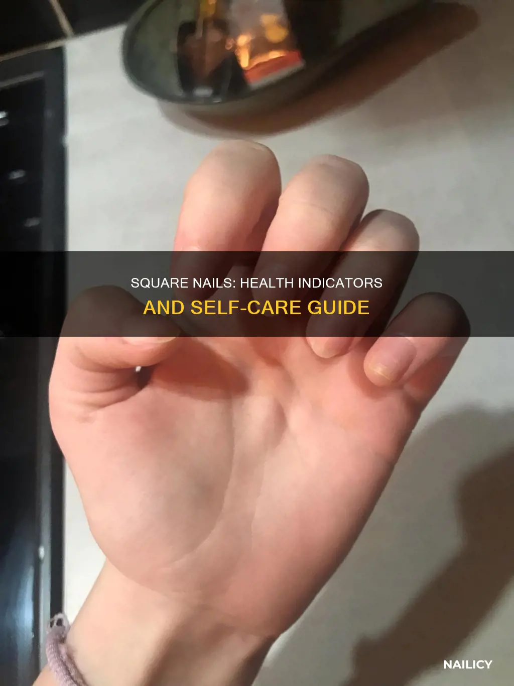 what does it mean when you have square nails health