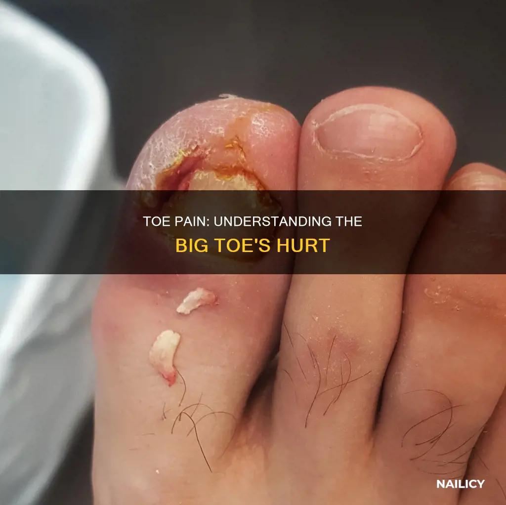 what does it mean when your big toe nail hurts