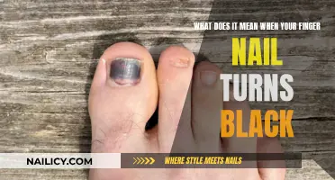 Nail Darkening: Understanding the Causes and When to Seek Help