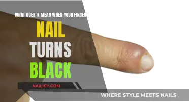 Black Fingernail: What Does It Mean?