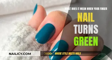 The Mystery of Green Nails: What's the Cause?