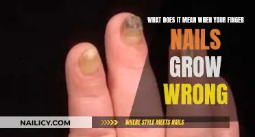 Unusual Nail Growth: Understanding the Causes and Seeking Solutions