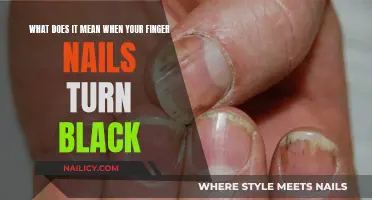 Black Nails: Understanding the Causes and When to Seek Help