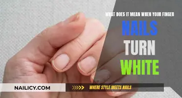 Fingernail Whites: What Your Nails Are Trying to Tell You