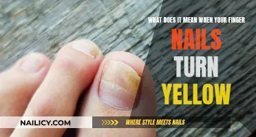 Yellow Nails: Understanding the Causes and When to Seek Help