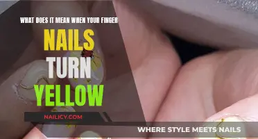 Yellow Nails: What Your Body is Trying to Tell You
