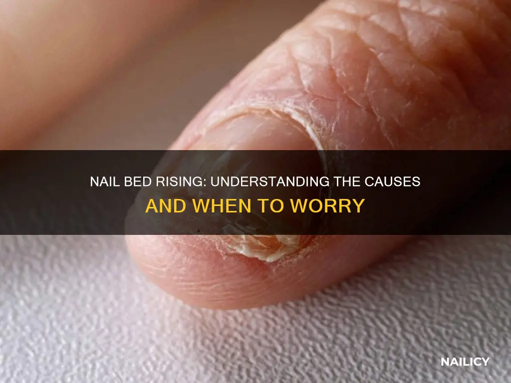 what does it mean when your nail bed is raised