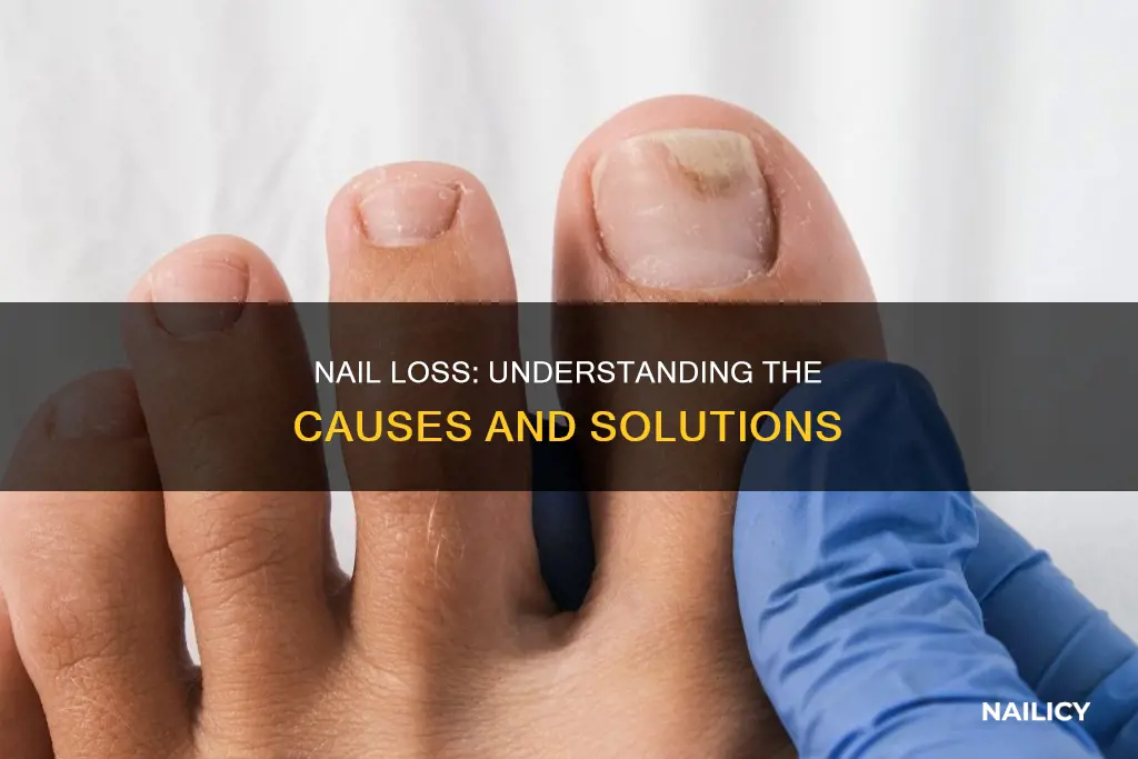 what does it mean when your nail comes off