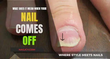 Nail Separation: What Does It Mean When Nails Detach?