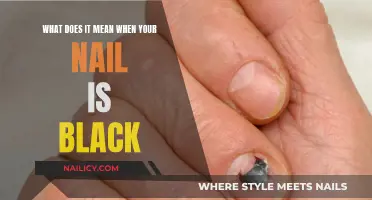 Nail Blackness: Understanding the Causes and When to Seek Help