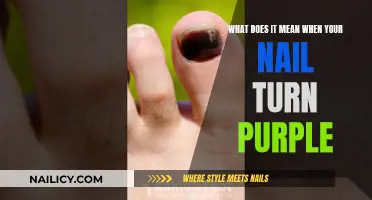 Purple Nail Mystery: Unraveling the Causes and Solutions