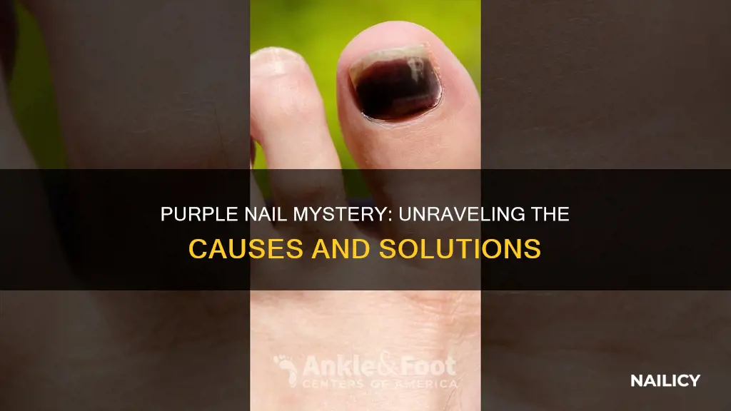 what does it mean when your nail turn purple