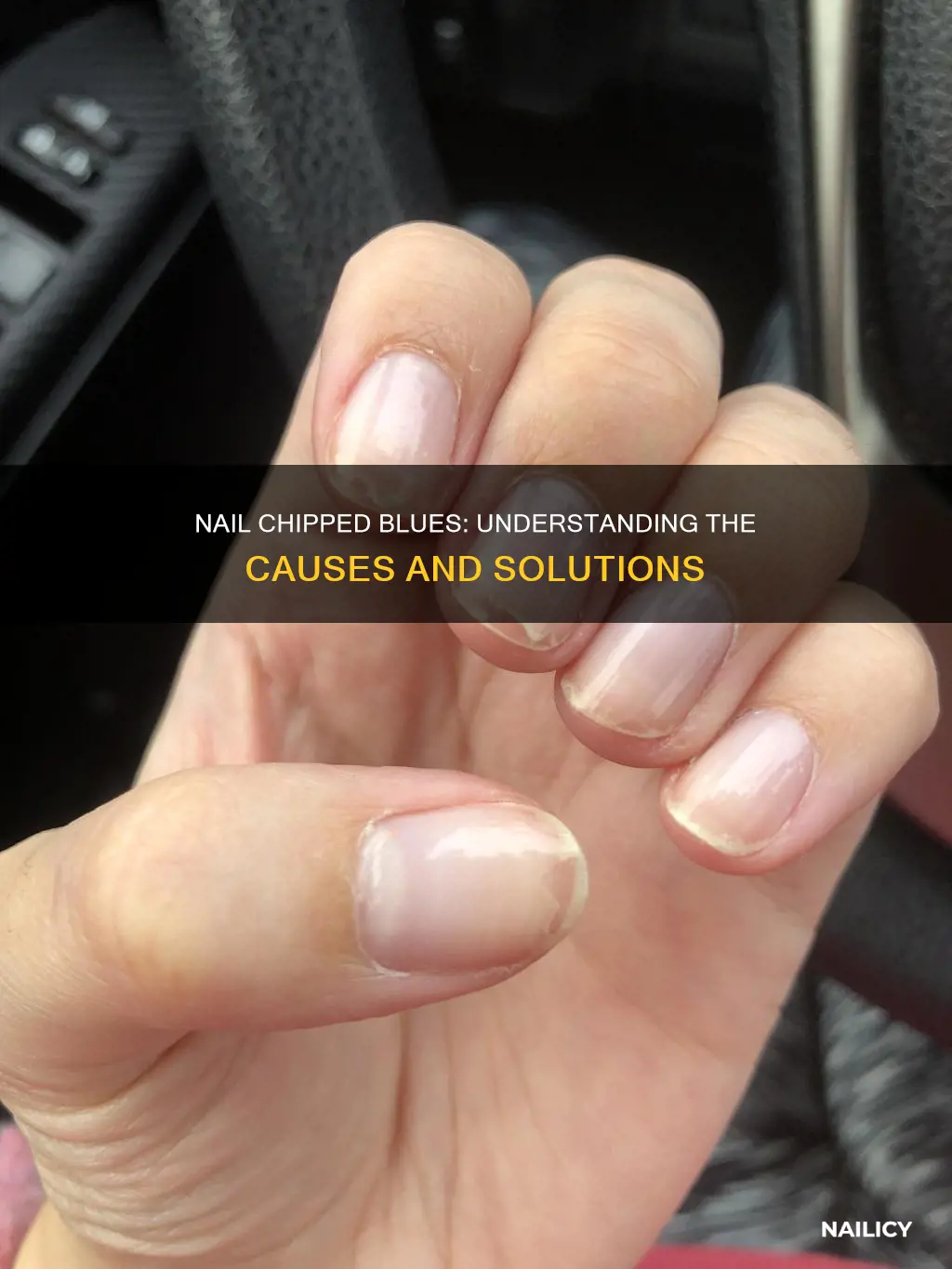 what does it mean when your nails are chipping