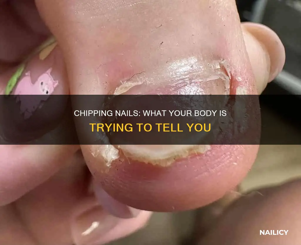 what does it mean when your nails are chipping
