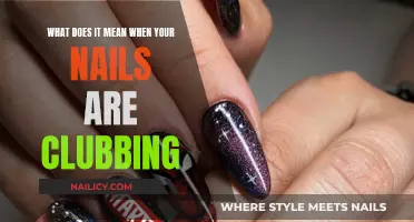 Nail Clubbing: What It Means and Why It Happens
