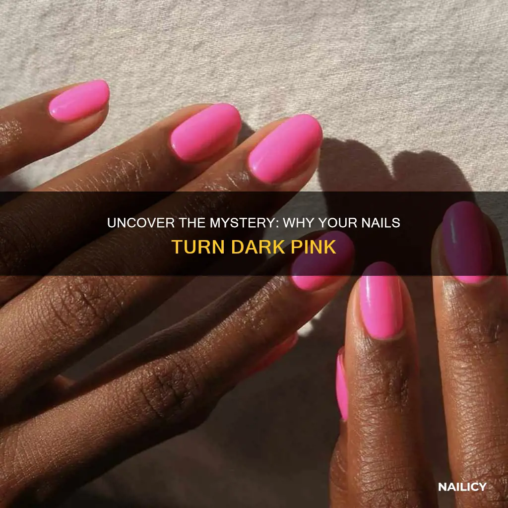 what does it mean when your nails are dark pink