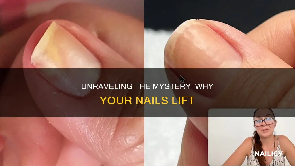 what does it mean when your nails are lifting