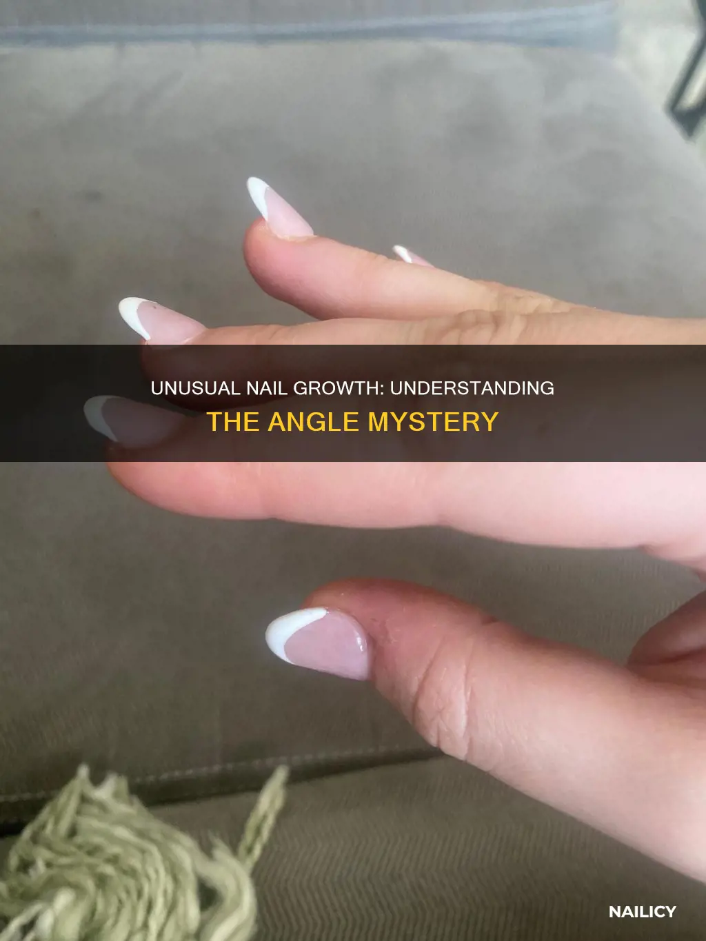 what does it mean when your nails grow angled