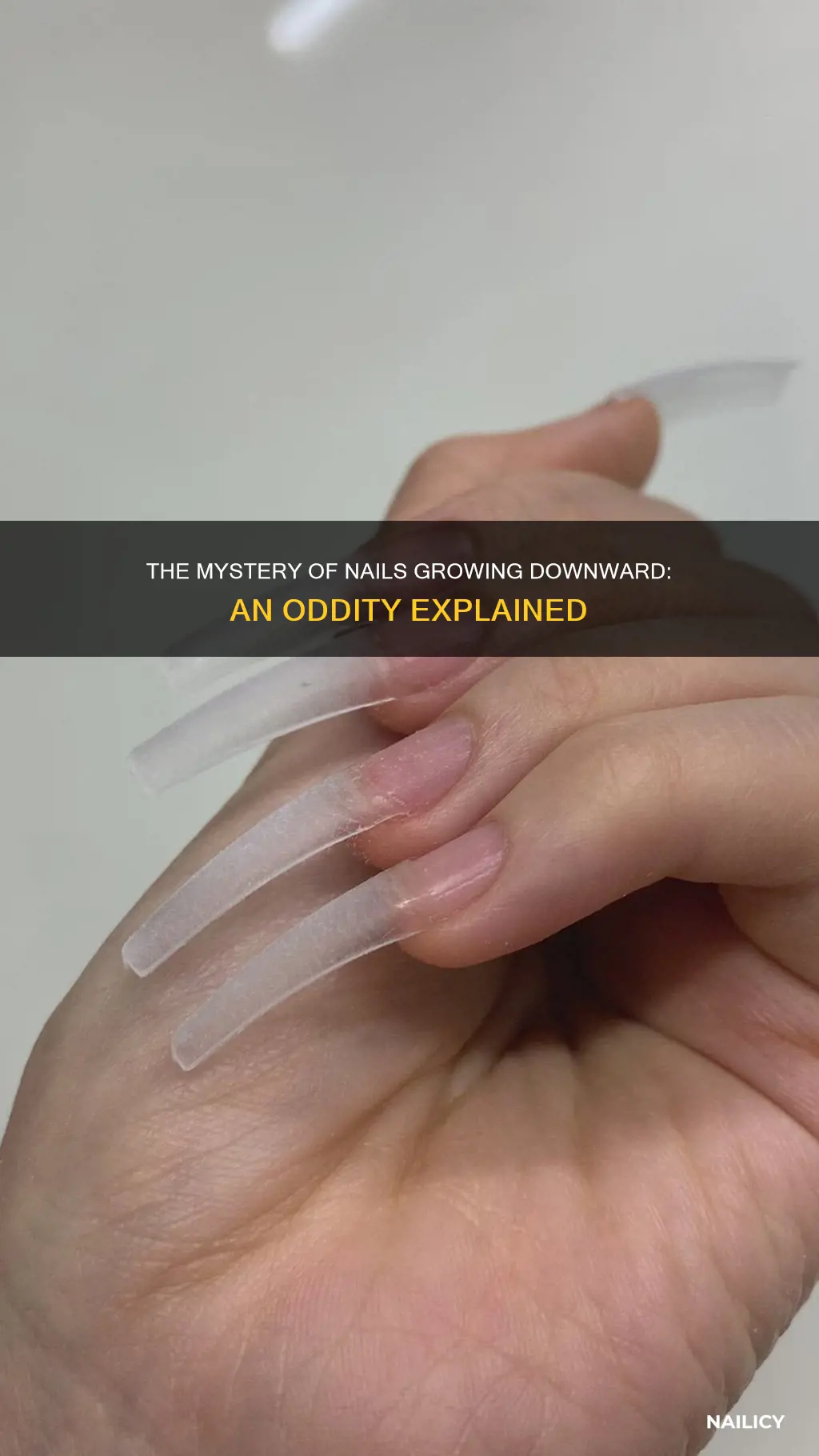 what does it mean when your nails grow down