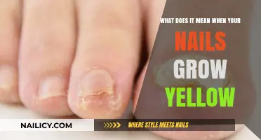 Yellow Nails: What Does It Mean?