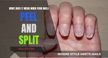 Nail Peel-Off: Understanding the Causes and When to Seek Help