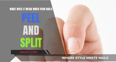The Mystery of Peeling, Splitting Nails: Causes and Solutions