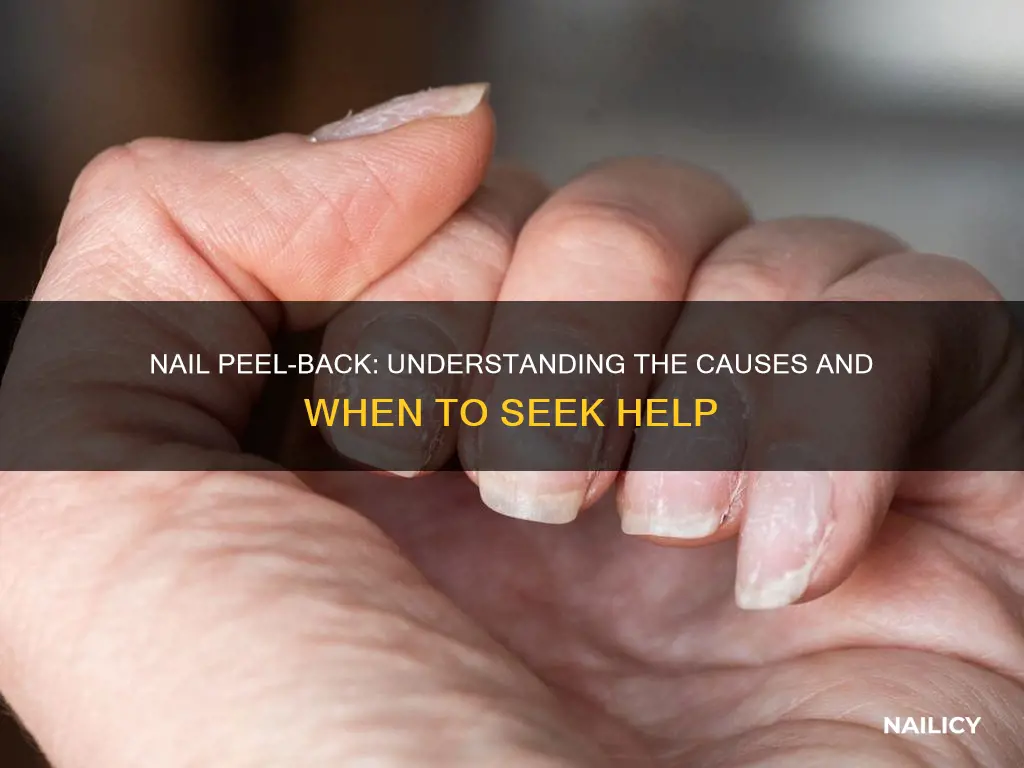 what does it mean when your nails peel back