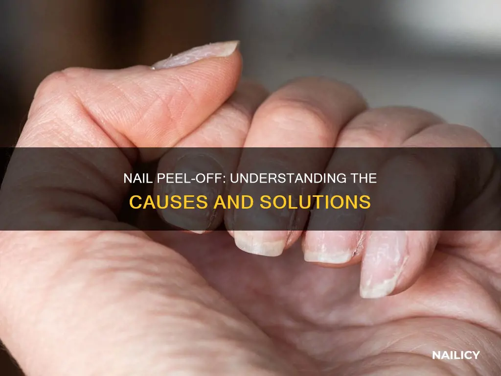 what does it mean when your nails peel in layers