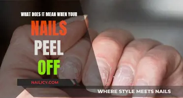 Nail Peel-Off: Understanding the Causes and When to Seek Help