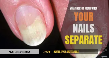 Nail Separation: Understanding the Causes and When to Seek Help