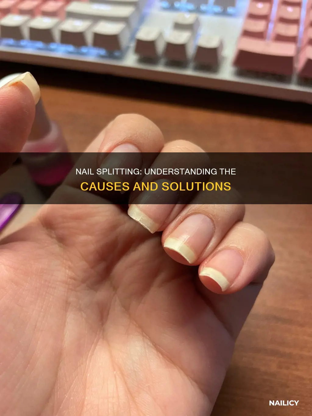 what does it mean when your nails split in layers