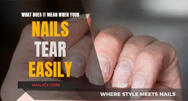 Nail Health Alert: Understanding the Signs of Weakness