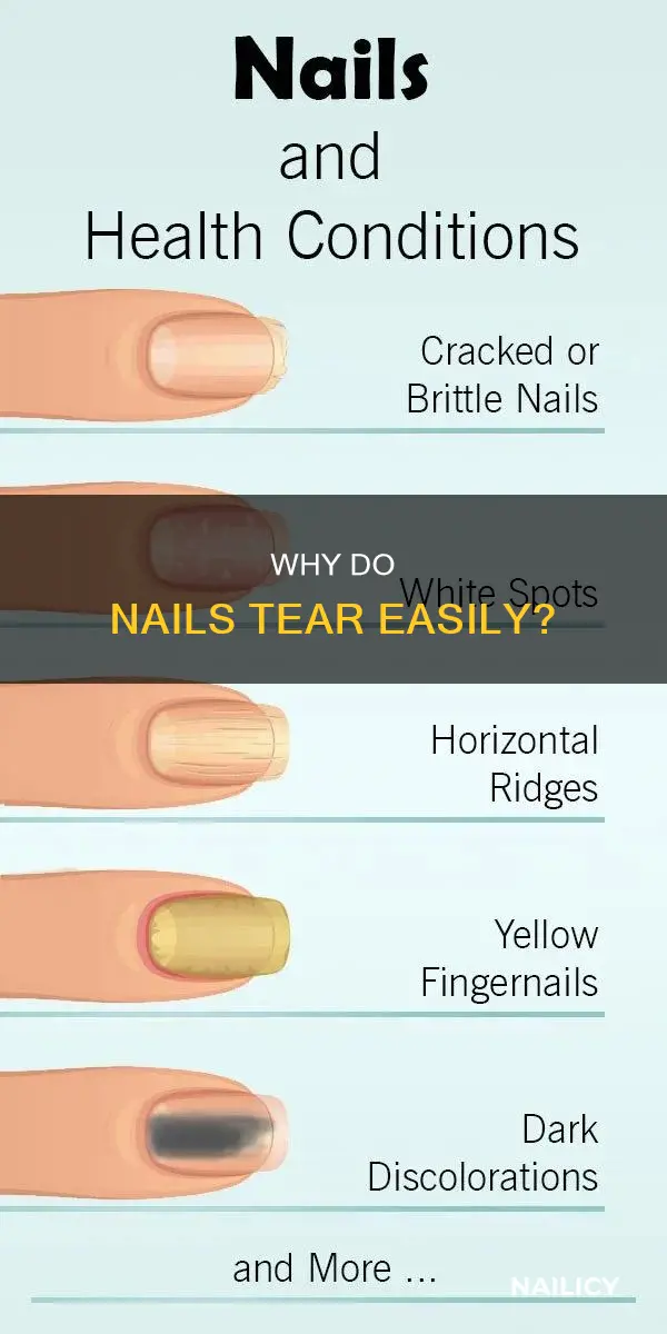 what does it mean when your nails tear easily