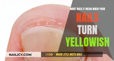 Yellowish Nails: What Does It Mean?