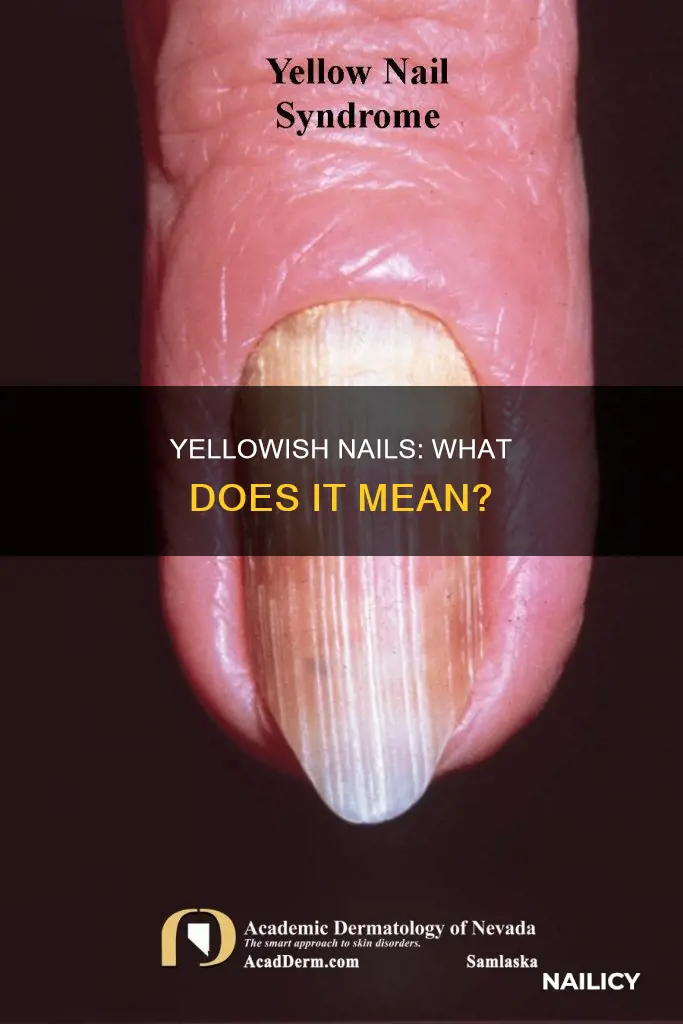 what does it mean when your nails turn yellowish